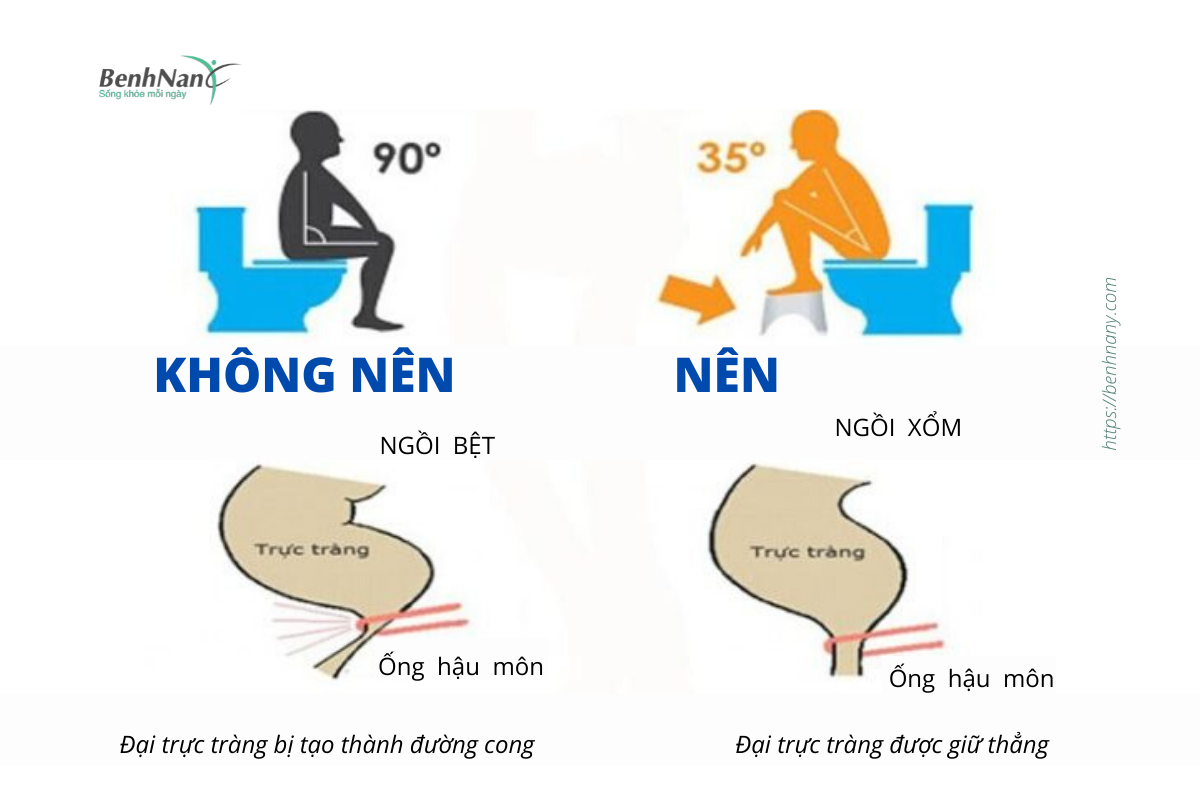Chữa bệnh trĩ tại nhà: Ăn uống, sinh hoạt như thế nào? 5 Lam the nao de khong bi tao bon