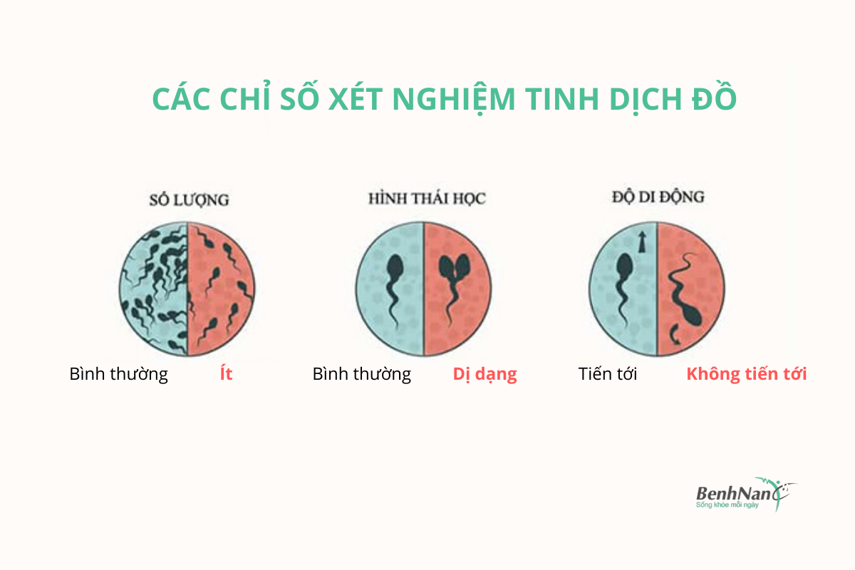 Chỉ số xét nghiệm tinh dịch đồ