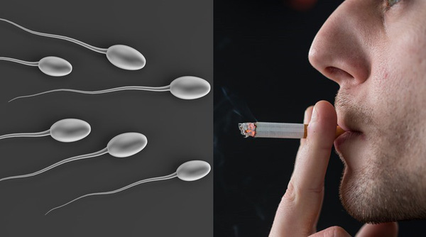 Những tác nhân từ bên trong, bên ngoài cơ thể khiến tinh trùng bị dị dạng Những tác nhân từ bên trong, bên ngoài cơ thể khiến tinh trùng bị dị dạng