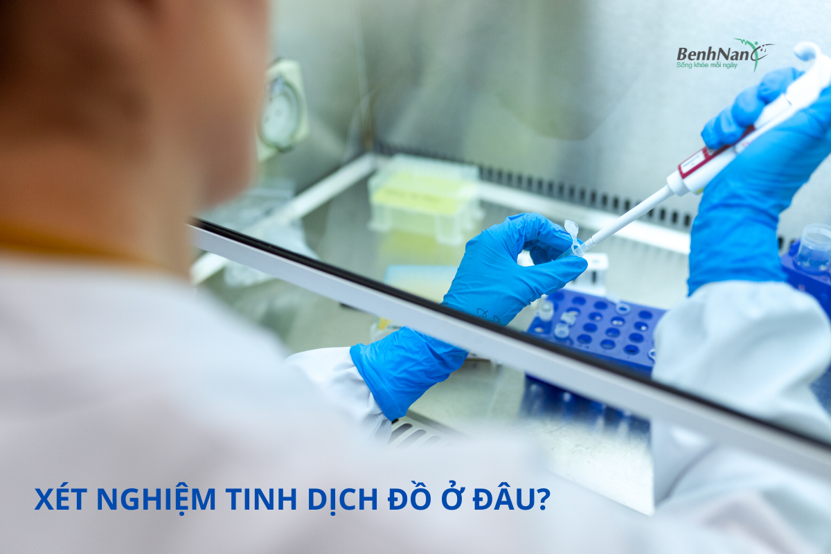 Xét nghiệm tinh dịch đồ ở đâu