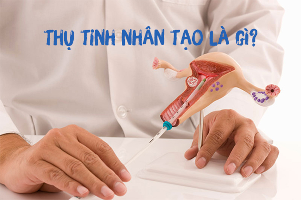 Hiểu rõ hơn về phương pháp bơm tinh trùng thụ tinh nhân tạo iui Hiểu rõ hơn về phương pháp bơm tinh trùng thụ tinh nhân tạo iui