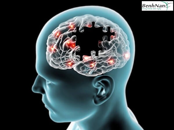 Bệnh tiểu đường tuýp 3 là gì? Có nguy hiểm không? 3 Chẩn đoán tiểu đường tuýp 3