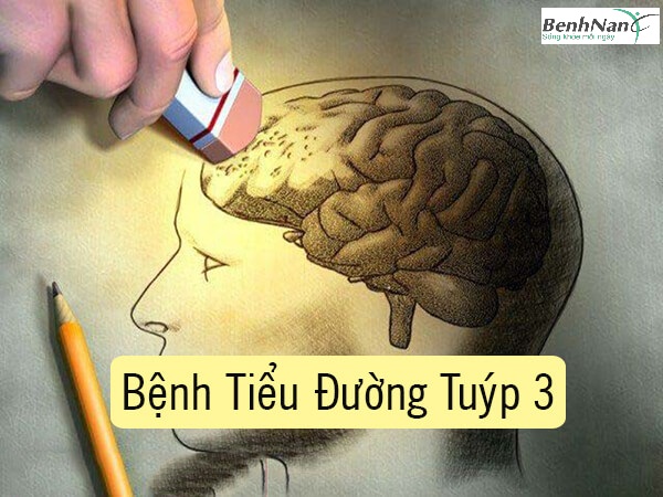 Triệu chứng bệnh tiểu đường tuýp 3 là gì?