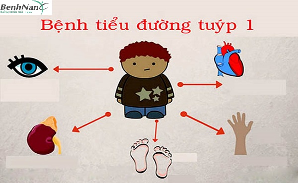 Bệnh tiểu đường tuýt 1 có nguy hiểm không? Có chữa được không? 1 bệnh tiểu đường tuýp 1 có nguy hiểm không