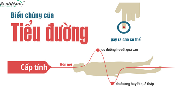 Bệnh tiểu đường tuýt 1 có nguy hiểm không? Có chữa được không? 3 Biến chứng mãn tính của bệnh tiểu đường tuýp 1 là gì?
