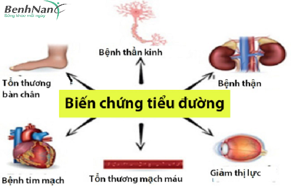 Tiểu đường type 2 chỉ số bao nhiêu nặng, bao nhiêu nhẹ và do đâu? 3 Biến chứng của tiểu đường type 2