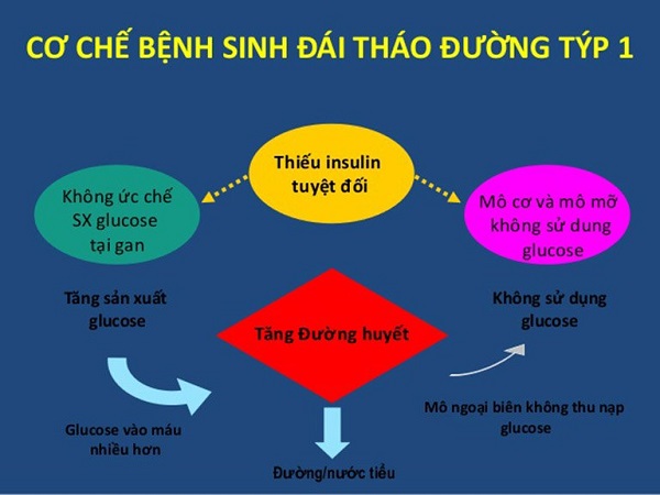 Tiểu đường type 1 và type 2 là gì? Có gì khác nhau? 1 tiểu đường type 1 là gì