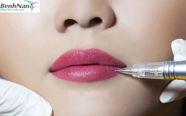 Người bị bệnh tiểu đường xăm môi được không? 1 bệnh tiểu đường xăm môi được không