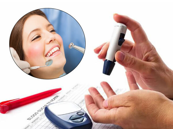 Bệnh tiểu đường nhổ răng được không? Vì sao? 1 bệnh tiểu đường nhổ răng được không
