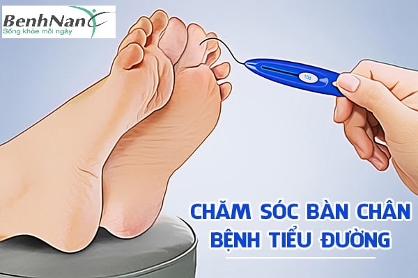 Mách bạn 10 cách chăm sóc bàn chân cho người tiểu đường 3 Các yếu tố nguy cơ đối với bàn chân của người tiểu đường
