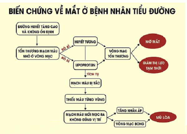 Mờ mắt do biến chứng tiểu đường: Nguyên nhân, cách phòng tránh hiệu quả 1 Mờ mắt do biến chứng tiểu đường