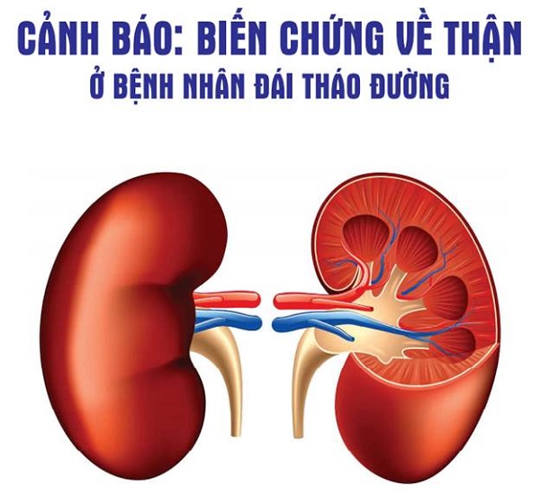 bien chung tieu duong o than 3483481
