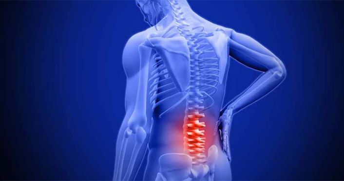 Những bài thuốc đông y chữa đau mỏi lưng khá hiệu quả 1 Chữa đau mỏi lưng do thấp nhiệt hạ chú